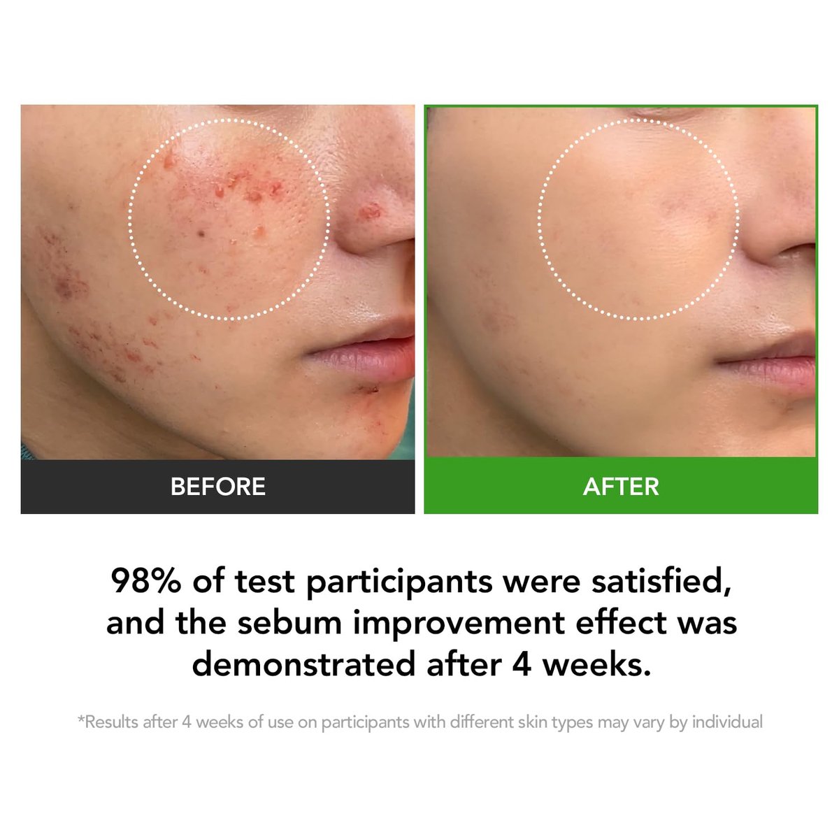 KIOSKIN Sebum Reduction Moisturizer – 31% Less Sebum, 15.5% D-Panthenol, Heartleaf Extract – Calms Redness, Repairs Barrier, Locks in Hydration – Korean Skincare Daily Moisturizer (1.18 fl oz) Avelisse