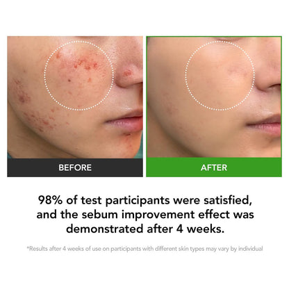KIOSKIN Sebum Reduction Moisturizer – 31% Less Sebum, 15.5% D-Panthenol, Heartleaf Extract – Calms Redness, Repairs Barrier, Locks in Hydration – Korean Skincare Daily Moisturizer (1.18 fl oz) Avelisse