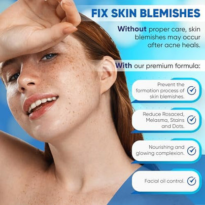 AOBBIY Azelaic Acid Cream – Premium Facial Moisturizer for Sensitive, Acne-Prone & Uneven Skin (1 Oz)