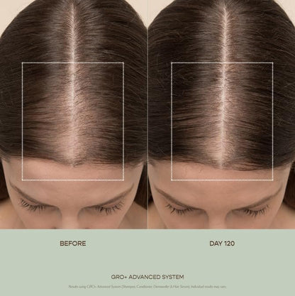 VEGAMOUR GRO+ Advanced Balancing Conditioner | Hydrates Scalp, Nourishes & Softens Hair | For Signs of Thinning | Color Safe, Vegan, Cruelty-Free, No Silicones (8 Fl Oz) Avelisse