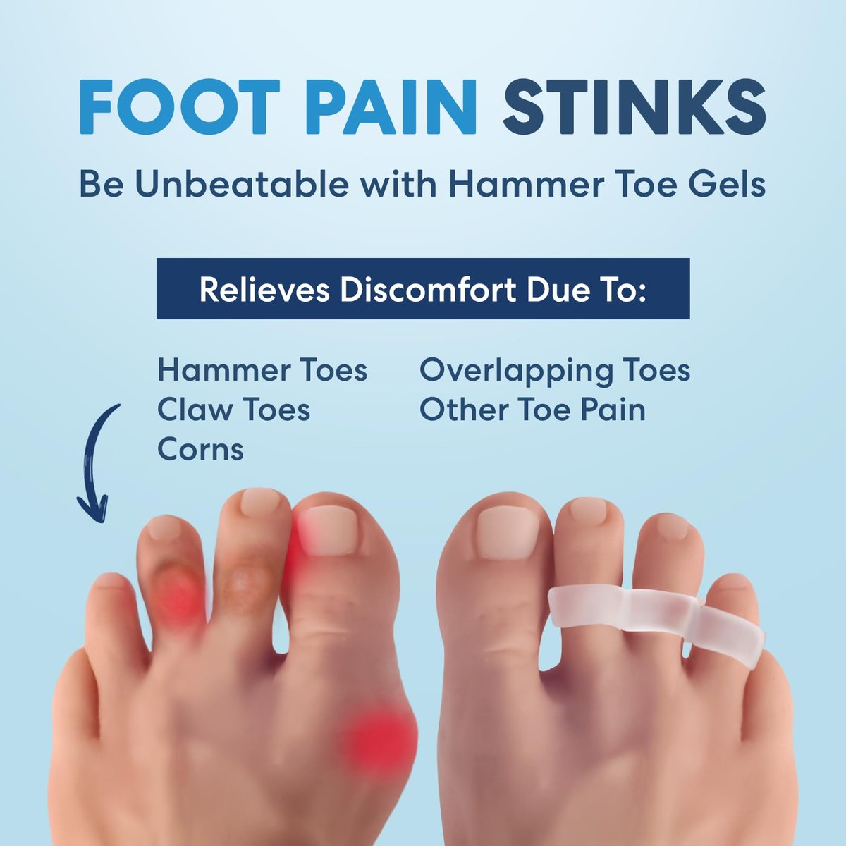 Dr. Frederick's Original Hammer Toe Corrector Gels - 2 Pairs - Clear, Firm Cushioning for Crooked & Overlapping Toes - All-Day Relief & Toe Alignment Support Avelisse