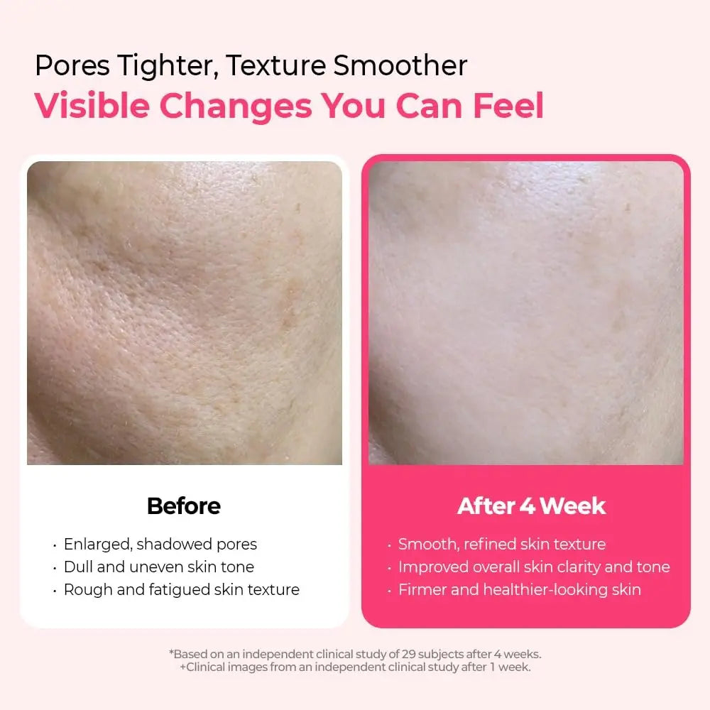 Dr.Melaxin Cyano Pink Spicule Serum with Vitamin B12, Liquid Microneedle Facial Treatment for Enlarged Pores, Niacinamide for Texture Refining & Renewal, 1.01 fl.oz Avelisse