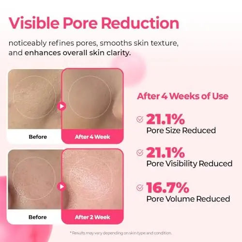 Dr.Melaxin Cyano Pink Spicule Serum with Vitamin B12, Liquid Microneedle Facial Treatment for Enlarged Pores, Niacinamide for Texture Refining & Renewal, 1.01 fl.oz Avelisse