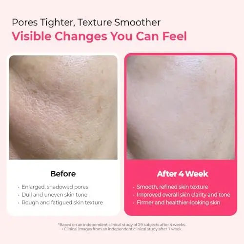 Dr.Melaxin Cyano Pink Spicule Serum with Vitamin B12, Liquid Microneedle Facial Treatment for Enlarged Pores, Niacinamide for Texture Refining & Renewal, 1.01 fl.oz Avelisse