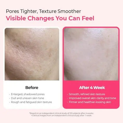Dr.Melaxin Cyano Pink Spicule Serum with Vitamin B12, Liquid Microneedle Facial Treatment for Enlarged Pores, Niacinamide for Texture Refining & Renewal, 1.01 fl.oz Avelisse