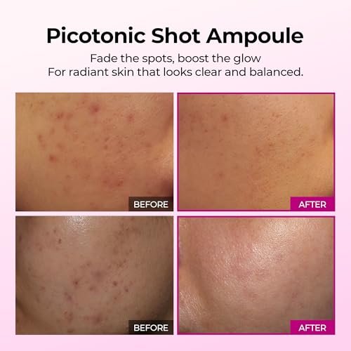 Dr.Melaxin Picotonic Shot Serum with Alpha-Arbutin & Niacinamide - Firming Density Serum for Even Skin Tone, Anti-Aging & Dark Spot Care, 1.01 fl.oz Avelisse