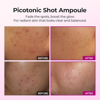 Dr.Melaxin Picotonic Shot Serum with Alpha-Arbutin & Niacinamide - Firming Density Serum for Even Skin Tone, Anti-Aging & Dark Spot Care, 1.01 fl.oz Avelisse