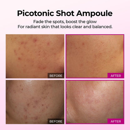 Dr.Melaxin Picotonic Shot Serum with Alpha-Arbutin & Niacinamide - Firming Density Serum for Even Skin Tone, Anti-Aging & Dark Spot Care, 1.01 fl.oz Avelisse