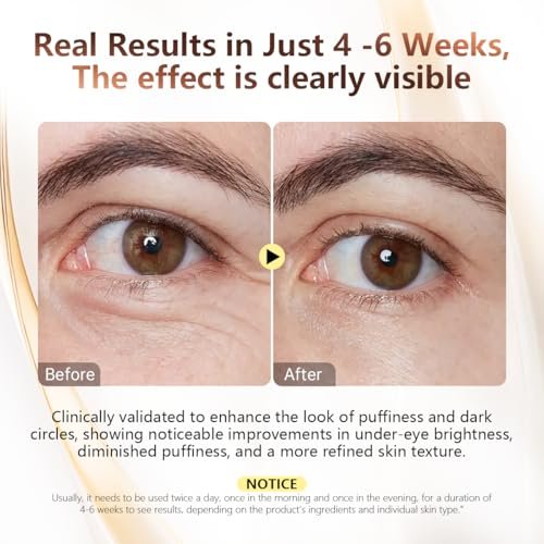 COSMOO Snail Peptide Under Eye Cream - Dark Circles, Puffiness, Wrinkles & Fine Lines Treatment with Snail Mucin & Niacinamide - Korean Skin Care Formula Avelisse