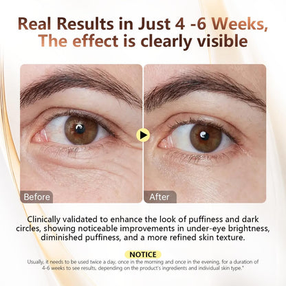 COSMOO Snail Peptide Under Eye Cream - Dark Circles, Puffiness, Wrinkles & Fine Lines Treatment with Snail Mucin & Niacinamide - Korean Skin Care Formula Avelisse