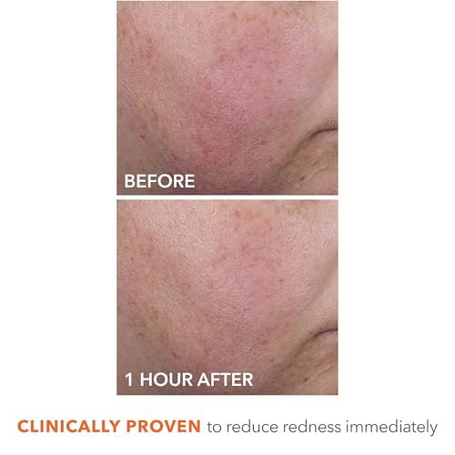 Dr Dennis Gross DermInfusions Blur + Repair Cream – Instantly Blurs Fine Lines, Smooths Skin with Satin-Matte Finish, Visibly Plumps & Firms, Reduces Redness, Improves Skin Elasticity, 1.7 Fl Oz Avelisse