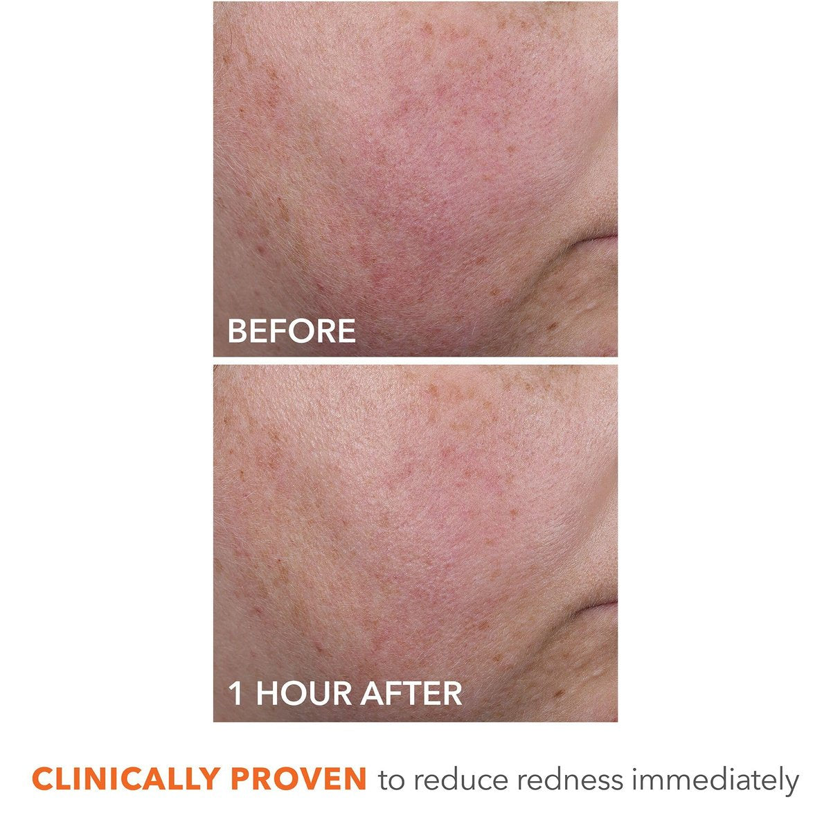 Dr Dennis Gross DermInfusions Blur + Repair Cream – Instantly Blurs Fine Lines, Smooths Skin with Satin-Matte Finish, Visibly Plumps & Firms, Reduces Redness, Improves Skin Elasticity, 1.7 Fl Oz Avelisse