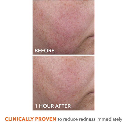 Dr Dennis Gross DermInfusions Blur + Repair Cream – Instantly Blurs Fine Lines, Smooths Skin with Satin-Matte Finish, Visibly Plumps & Firms, Reduces Redness, Improves Skin Elasticity, 1.7 Fl Oz Avelisse