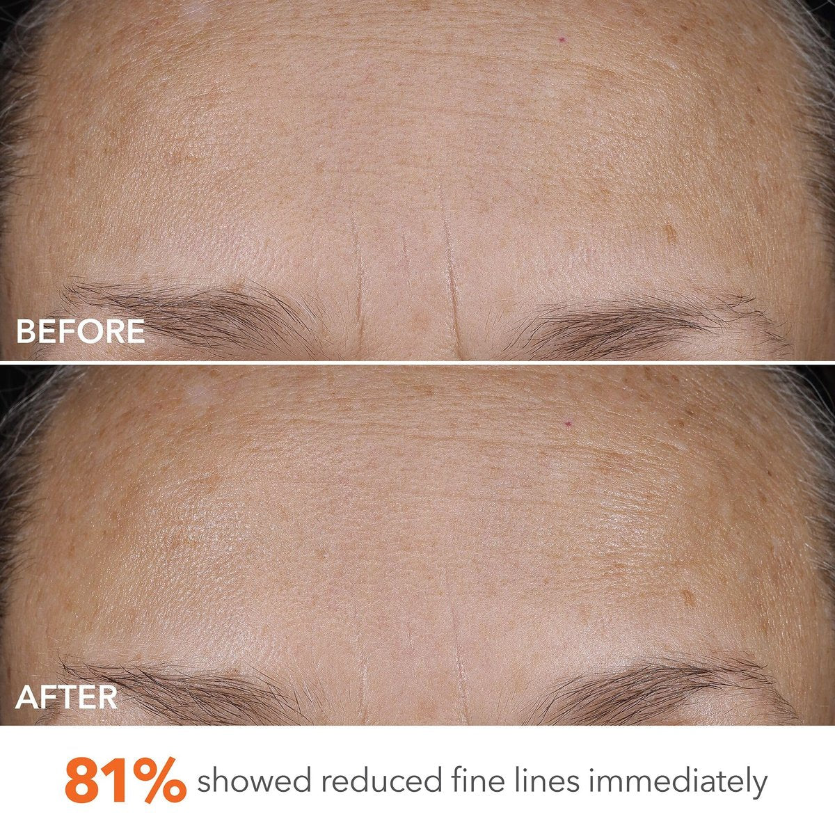 Dr Dennis Gross DermInfusions Blur + Repair Cream – Instantly Blurs Fine Lines, Smooths Skin with Satin-Matte Finish, Visibly Plumps & Firms, Reduces Redness, Improves Skin Elasticity, 1.7 Fl Oz Avelisse