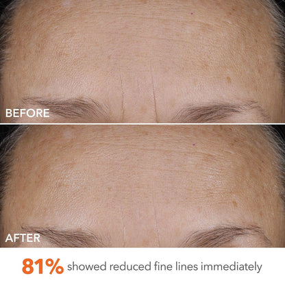 Dr Dennis Gross DermInfusions Blur + Repair Cream – Instantly Blurs Fine Lines, Smooths Skin with Satin-Matte Finish, Visibly Plumps & Firms, Reduces Redness, Improves Skin Elasticity, 1.7 Fl Oz Avelisse