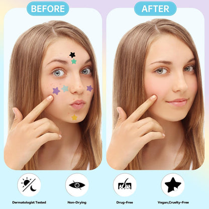 Waspot Star Pimple Patches for Face - 240 Count Hydrocolloid Zit Covers with Tea Tree, Salicylic Acid & Cica Oil for Sensitive Skin