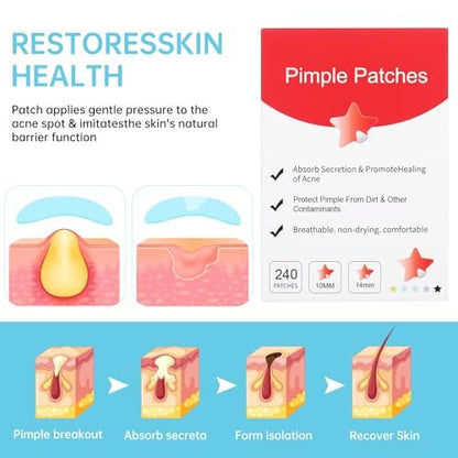 Waspot Star Pimple Patches for Face - 240 Count Hydrocolloid Zit Covers with Tea Tree, Salicylic Acid & Cica Oil for Sensitive Skin