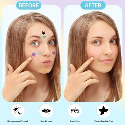Waspot Star Pimple Patches for Face - 240 Count Hydrocolloid Zit Covers with Tea Tree, Salicylic Acid & Cica Oil for Sensitive Skin