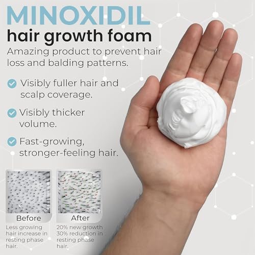 Remixidil Men's 5% Minoxidil Foam – Clinically Proven Hair Regrowth Treatment, 3-Month Supply, No Scalp Irritation Avelisse