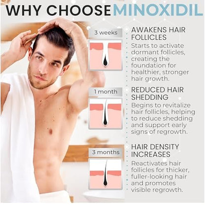 Remixidil Men's 5% Minoxidil Foam – Clinically Proven Hair Regrowth Treatment, 3-Month Supply, No Scalp Irritation Avelisse