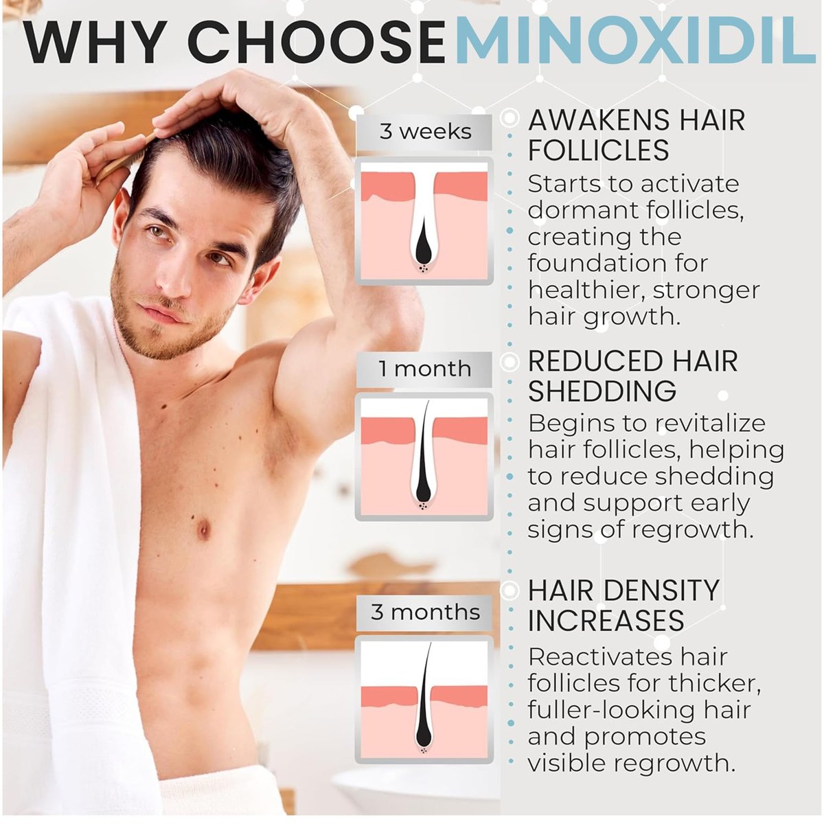 Remixidil Men's 5% Minoxidil Foam – Clinically Proven Hair Regrowth Treatment, 3-Month Supply, No Scalp Irritation Avelisse