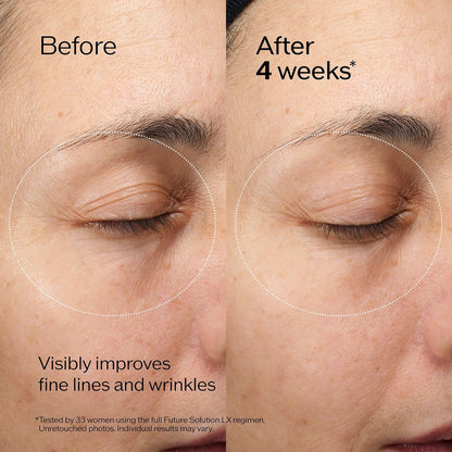Shiseido Future Solution LX Eye and Lip Contour Regenerating Cream - 0.6 Fl Oz - Visibly Improves Wrinkles & Sagging Around Eyes and Mouth - All Skin Types Avelisse