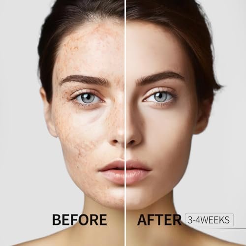 HANYWIL Dark Spot Remover for Face and Body | Dark Spot Corrector Serum with Roller for Age Spots, Sun Spots, Freckles, Melasma - görsel 6