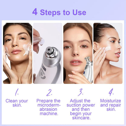 Diamond Professional Microdermabrasion Machine – Portable Home Use Crystal Dermabrasion for Facial Skin Care, Blackhead Remover Kit for Women & Men Avelisse