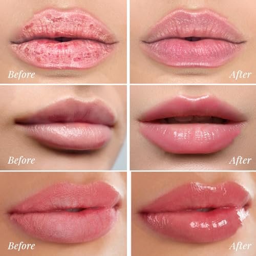 ANRCOLLECT Lip Mask Overnight Set, 4Pcs Lip Care Hydration Treatment Exfoliator Mask Kit, Revives & Nourishes Gift Set for All Day Moisturizing with Collagen & Shea Butter Avelisse