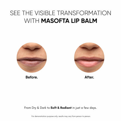 Masofta Shea Butter Lip Balm with Kojic Acid, Alpha Arbutin & SPF 30 PA++ - 0.53 oz Avelisse