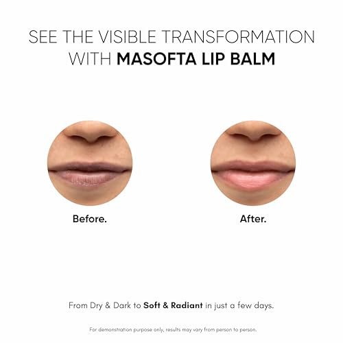 Masofta Shea Butter Lip Balm with Kojic Acid, Alpha Arbutin & SPF 30 PA++ - 0.53 oz Avelisse