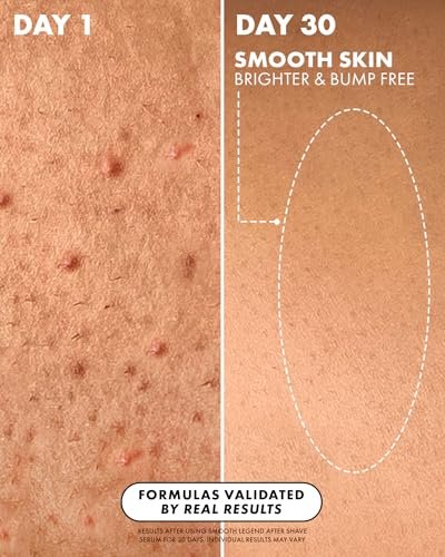 Truly Beauty Smooth Legend After Shave Serum | Reduces Bumps, KP & Strawberry Skin | Hydrating Treatment with Peptides, Hyaluronic Acid & Aloe Extract | Smooths & Calms Skin (3.1 Fl Oz) - görsel 6