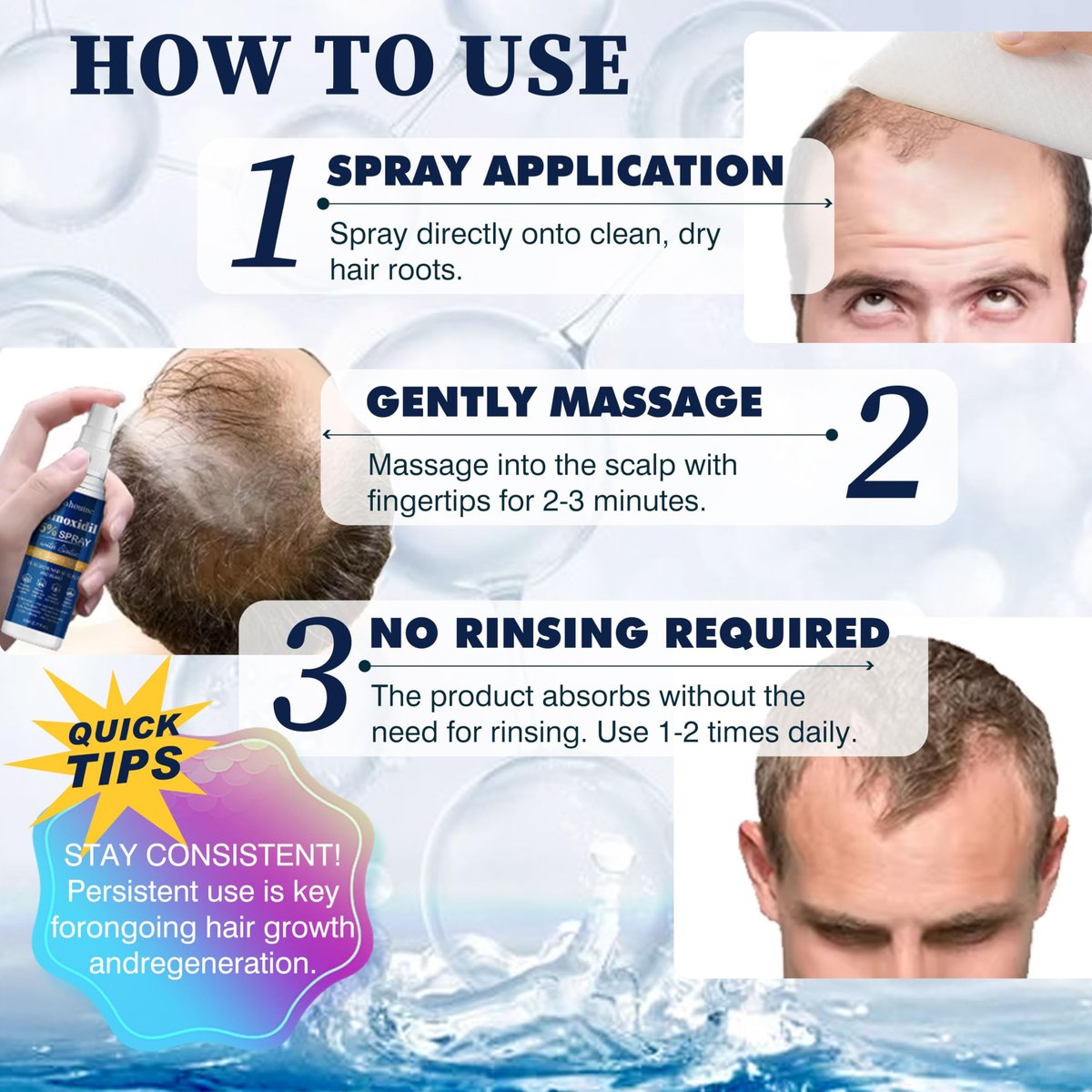 5% Minoxidil Hair Growth Spray Serum - Hair Regrowth Treatment for Men and Women, Strengthens and Thickens Hair for Fuller, Longer Results, Beard and Facial Hair Enhancer - görsel 11
