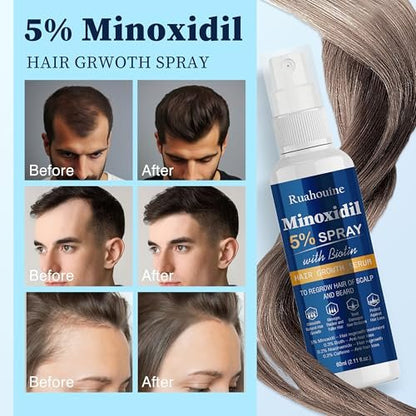 5% Minoxidil Hair Growth Spray Serum - Hair Regrowth Treatment for Men and Women, Strengthens and Thickens Hair for Fuller, Longer Results, Beard and Facial Hair Enhancer