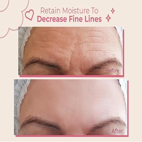 Bayside Forehead Wrinkle Patches | Non-Invasive Reusable Skin Care Solution for Fine Lines & Wrinkles | Pack of 2 Avelisse