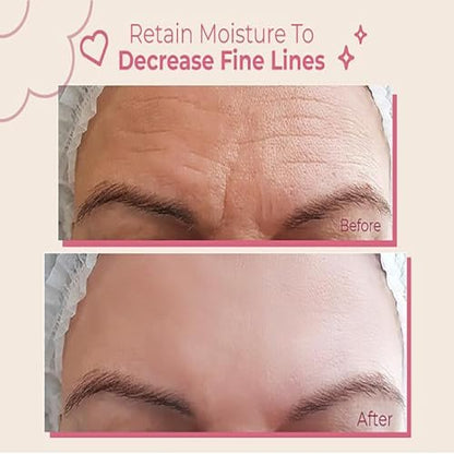 Bayside Forehead Wrinkle Patches | Non-Invasive Reusable Skin Care Solution for Fine Lines & Wrinkles | Pack of 2 Avelisse