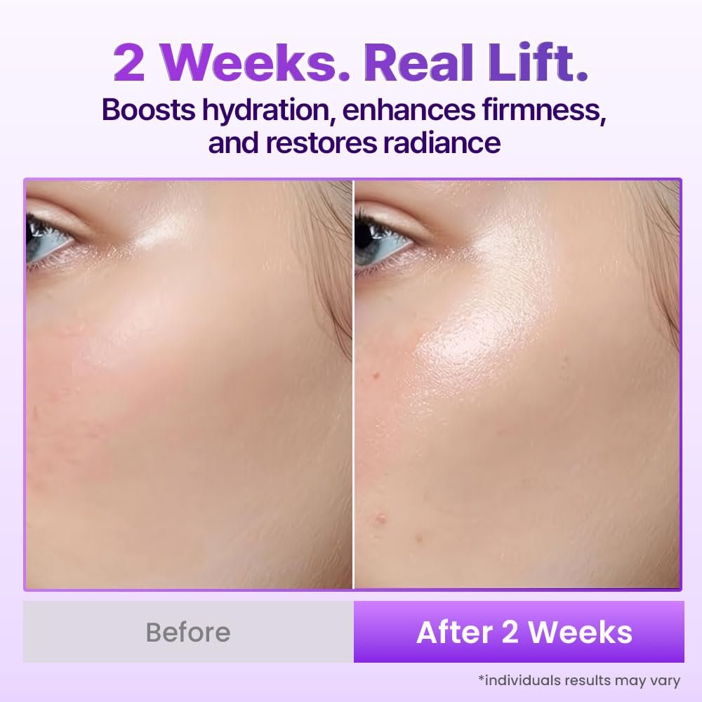 BIOHEAL BOH Probioderm 3D Lifting Cream Mist - 3.38 fl oz | Korean Face Mist for Instant Glow & Firm Skin Avelisse