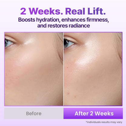 BIOHEAL BOH Probioderm 3D Lifting Cream Mist - 3.38 fl oz | Korean Face Mist for Instant Glow & Firm Skin Avelisse