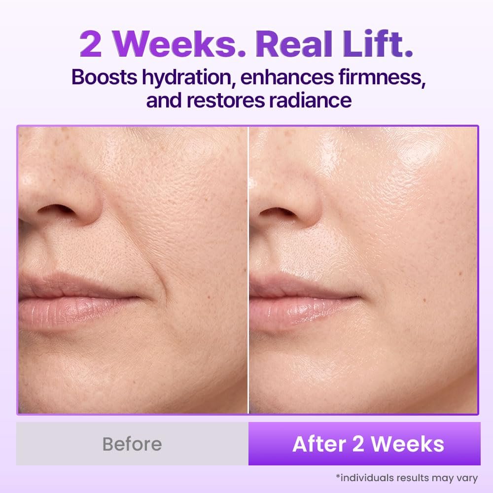 BIOHEAL BOH Probioderm 3D Lifting Cream Mist - 3.38 fl oz | Korean Face Mist for Instant Glow & Firm Skin Avelisse