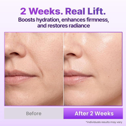 BIOHEAL BOH Probioderm 3D Lifting Cream Mist - 3.38 fl oz | Korean Face Mist for Instant Glow & Firm Skin Avelisse