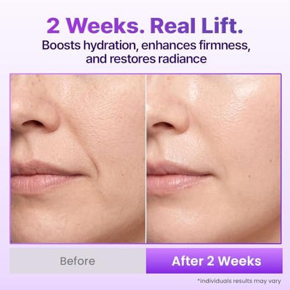 BIOHEAL BOH Probioderm 3D Lifting Cream Mist - 3.38 fl oz | Korean Face Mist for Instant Glow & Firm Skin Avelisse