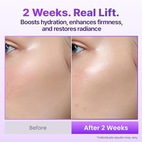 BIOHEAL BOH Probioderm 3D Lifting Cream Mist - 3.38 fl oz | Korean Face Mist for Instant Glow & Firm Skin Avelisse