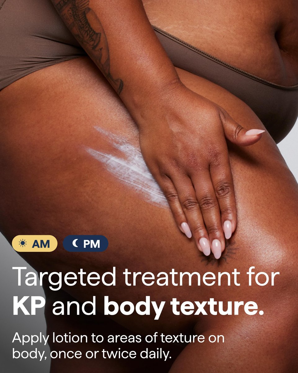 KP Exfoliating Body Moisturizer for Keratosis Pilaris & Crepey Skin | Remedy Science by Dr. Shah Avelisse
