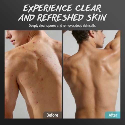 Men Body Scrub with Tea Tree Oil – Exfoliating Body Scrub for Men, Improves Odor, Smooths Rough Skin, Body Exfoliator for Back, Chest, Shoulders, Butt, Legs, Mens Exfoliating Body Wash with 2% BHA & 10% AHA (13.5 Fl Oz) Avelisse