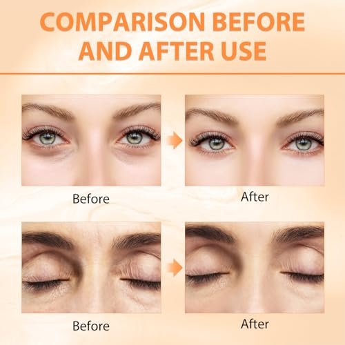 Tbexem Revive Glow Vitamin C Eye Balm - Hydrating Eye Cream for Dark Circles, Brightening & Puffiness (2-Pack) Avelisse