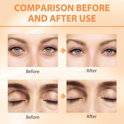 Tbexem Revive Glow Vitamin C Eye Balm - Hydrating Eye Cream for Dark Circles, Brightening & Puffiness (2-Pack) Avelisse