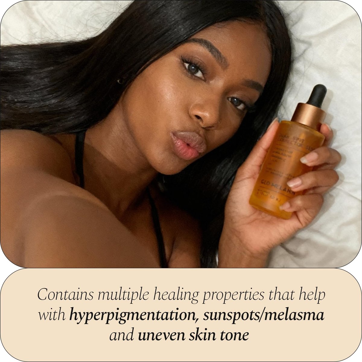 Glo Melanin Dark Spot Remover & Corrector Serum for Face with Vitamin C | Reduces Hyperpigmentation & Discoloration Avelisse