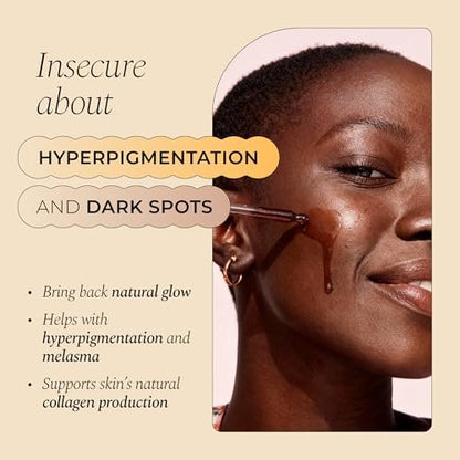 Glo Melanin Dark Spot Remover & Corrector Serum for Face with Vitamin C | Reduces Hyperpigmentation & Discoloration Avelisse