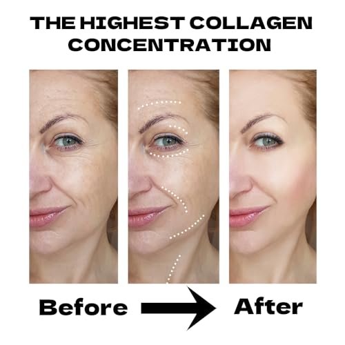 MKBLNP Collagen Face Mask - Hydrating Overnight Collagen Face Mask (6 pcs/1 Box) - Deep Collagen Anti Wrinkle Lifting Mask for Improved Elasticity, Firming, and Moisturizing - görsel 6