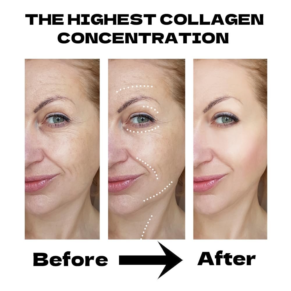 MKBLNP Collagen Face Mask - Hydrating Overnight Collagen Face Mask (6 pcs/1 Box) - Deep Collagen Anti Wrinkle Lifting Mask for Improved Elasticity, Firming, and Moisturizing - görsel 5